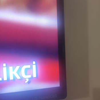 LG Televizyon Servis Sorunları Ve Yetersiz Müşteri Hizmeti