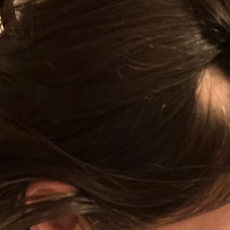 Saç Dökülmesi Şoku