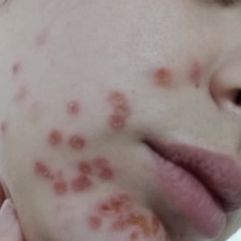 Yüzümde Kalan İzlerin Hesabı