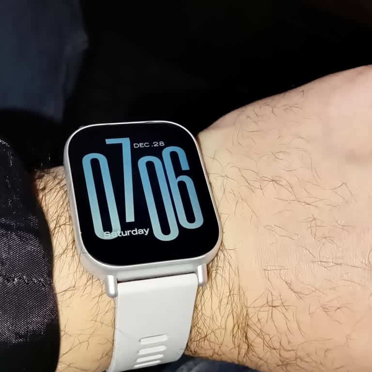 Xiaomi Redmi Watch 5 Bildirim Sorunu Ve Servis Erişimsizliği