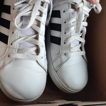 Garanti Süresinde Ayakkabı Sorunları Ve Kullanıcı Hatası İddiası