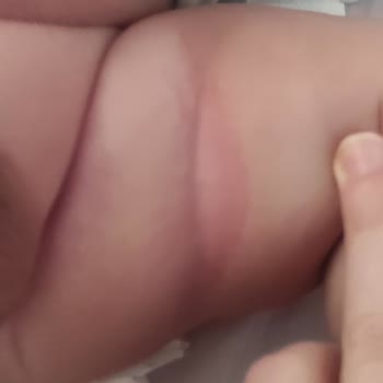 Sleepy Bezlerin Kalitesiz Yapısı Bebeğimi Rahatsız Etti