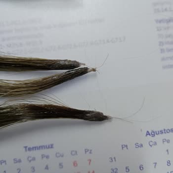 Saç Ekimi Deneyiminde Hayal Kırıklığı