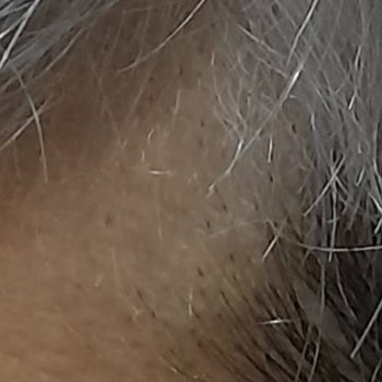 Beklenenin Altında Hizmet Deneyimi