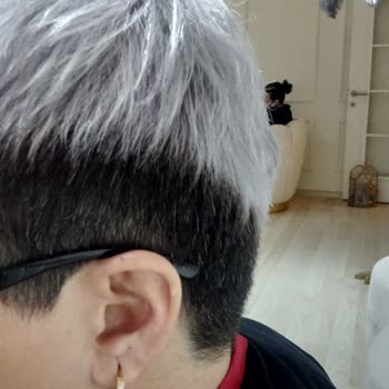 Beklenenin Altında Hizmet Deneyimi