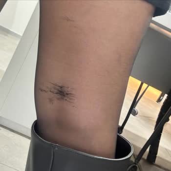 Çizme Üretim Hatası Ve Müşteri Hizmetleri İlgisizliği