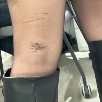 Çizme Üretim Hatası Ve Müşteri Hizmetleri İlgisizliği