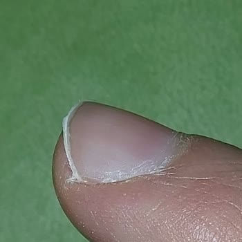 Tırnak Makası Kabusu: Nascita