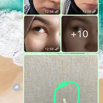 Başarısız Ameliyat Sonrası Mağduriyet