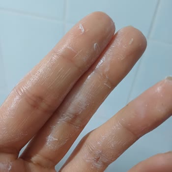 Orva İlaç Sanayi Expigment Kremin İçinden Çıkan Şeyler!