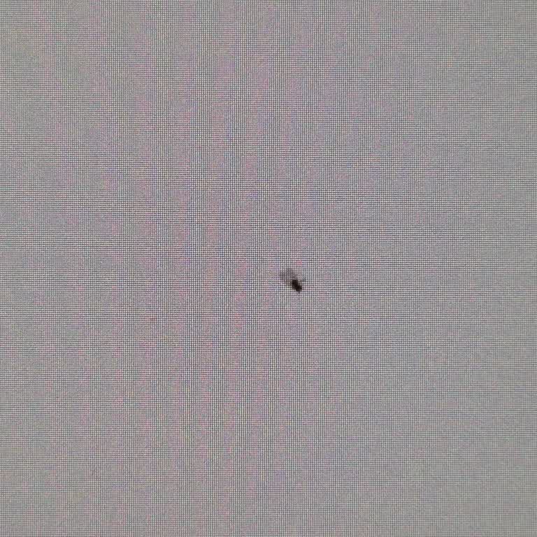 Yenilenen Monitörde Yabancı Cisim Şoku