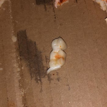 Migros'tan Aldığım Pizza Dişimizi Kırdı Müşteri Hizmetleri Cevapsız