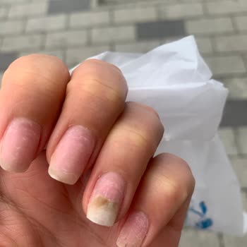 Hijyen Sorunları Ve Yanıltıcı Bilgilendirme: Tuğçem Güzellik Merkezi'nde Yaşadığım Hayal Kırıklığı