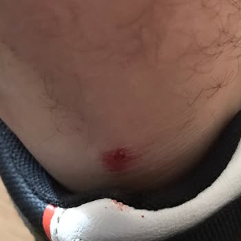 FLO'dan Aldığım Ayakkabı Ayağımı Kesti, Çözüm Bulamıyorum