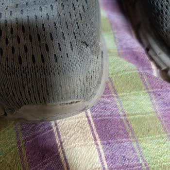 Skechers Ayakkabı Kalitesizliği Ve Garanti Sorunu