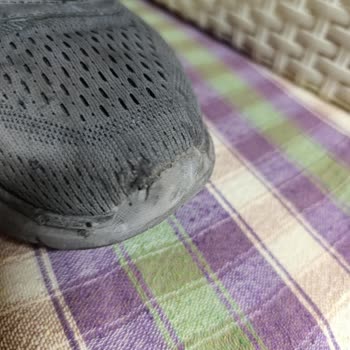 Skechers Ayakkabı Kalitesizliği Ve Garanti Sorunu