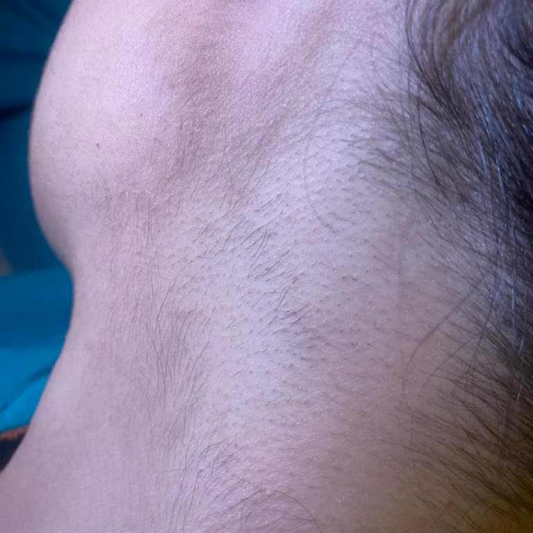 Epilasyon Hizmetinde Beklenmedik Sorunlar