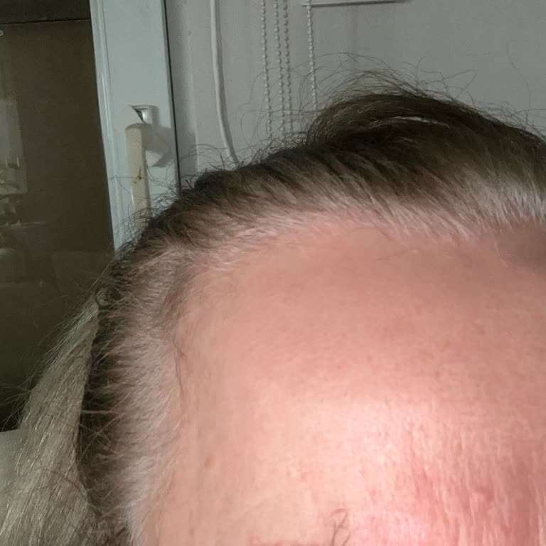 Bienist Kurtköy Güzellik Merkezinde Hayal Kırıklığı: Kaş Ve Lazer Epilasyon Hizmetleri