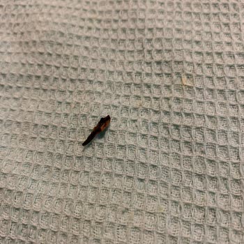 Ceviz İçi Paketinden Çıkan Tehlikeli Sürpriz