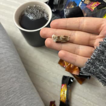 Üründen Çıkan Tuhaf Cisim Ve Koku Şoku