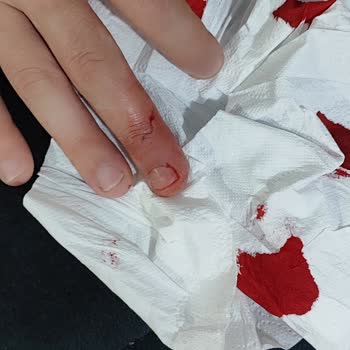 Tehlikeli Ayak Törpüsü Deneyimi