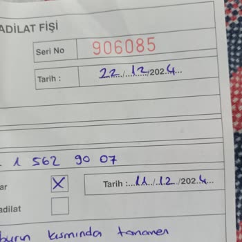 Dayanıklılık Testini Geçemeyen Bot