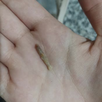 Beşler Tavuk Dönerde Kemik Şoku!