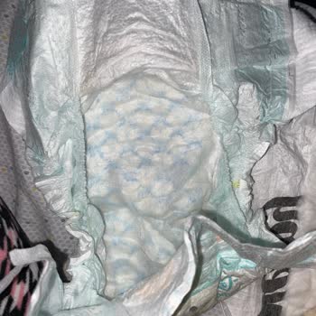 Prima 2 Numara Bebek Bezi Sızıntı Problemi