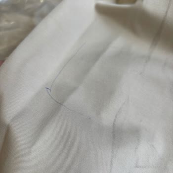 İade Sürecinde Müşteri Hizmetleri Sorunu Ve Geri Dönüş Eksikliği