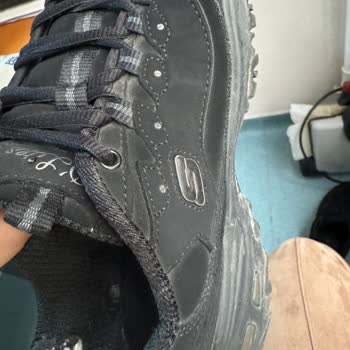 Skechers Ayakkabıda Beklenmedik Yıpranma Sorunu