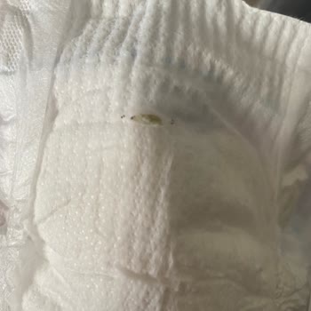 Molfix Bebek Bezinde Kurt Sorunu