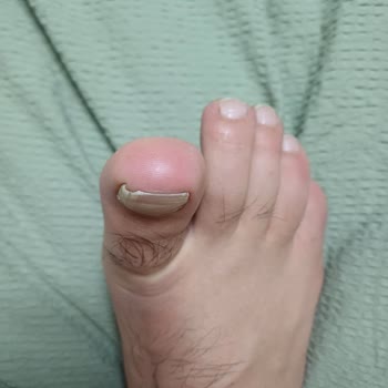 Podocity Sonuç Alamadım