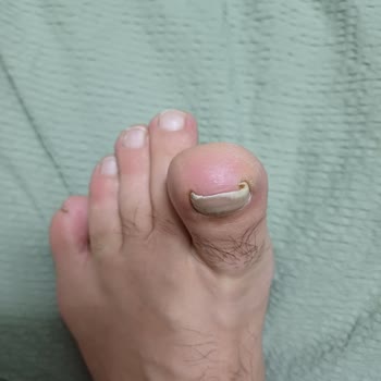 Podocity Sonuç Alamadım