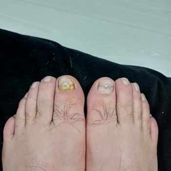 Podocity Sonuç Alamadım