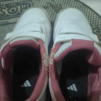 Adidas Çocuk Ayakkabısında Hızlı Deformasyon Sorunu