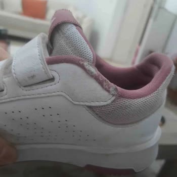 Adidas Çocuk Ayakkabısında Hızlı Deformasyon Sorunu