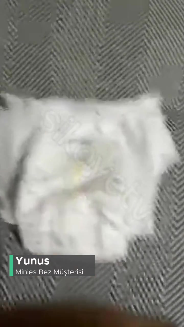 Minies Bebek Bezi Hatası! videonun kapak resmi