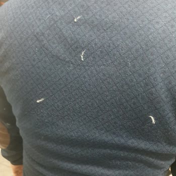 Boyner'den Aldığım Montun Tüy Sorunu Ve Değişim Talebi