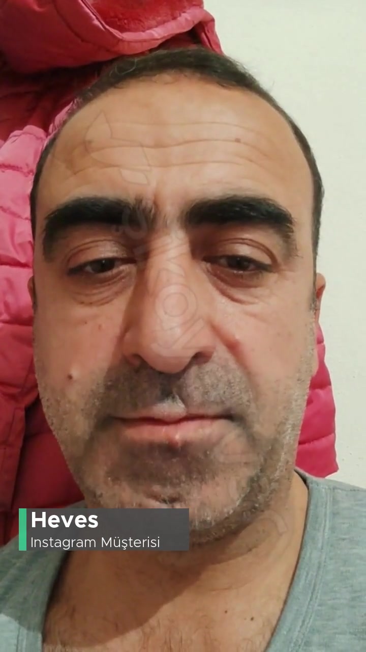 Instagram Hesabı Kurtarmak İstiyorum! videonun kapak resmi