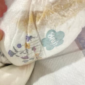 Goon Bebek Bezi: Hayal Kırıklığı Ve Sızdırma Sorunu
