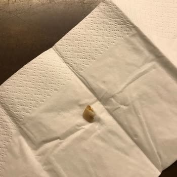 Eti Canga Tüketimi Sonrası Dişim Kırıldı: Acil Çözüm Bekliyorum