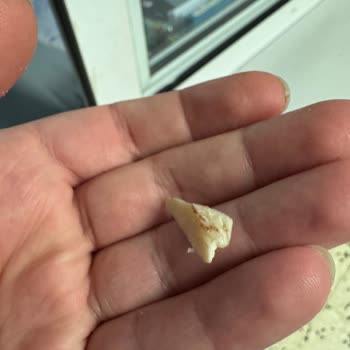 Çocuğumun Hayatını Tehlikeye Atan Üründe Kemik Parçası