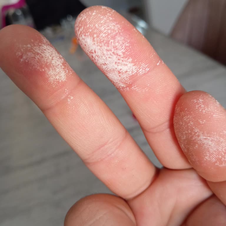 Tehlikeli Ürün Kullanım Deneyimi