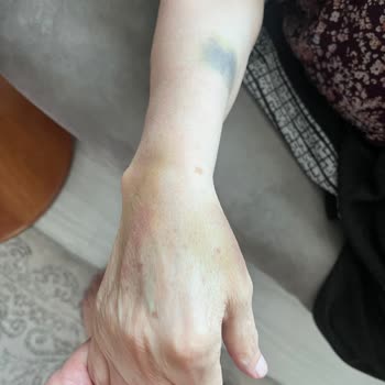 Koç Üniversitesi Acil Ameliyat Gerektiren Durumda Hastanede Yaşanan Sorunlar Ve Gereksiz Gecikmeler