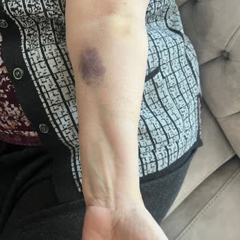 Koç Üniversitesi Acil Ameliyat Gerektiren Durumda Hastanede Yaşanan Sorunlar Ve Gereksiz Gecikmeler