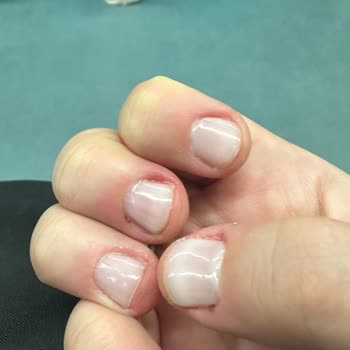 Ağrı Ve Kanama: Manikür Kabusu