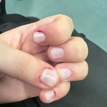 Ağrı Ve Kanama: Manikür Kabusu