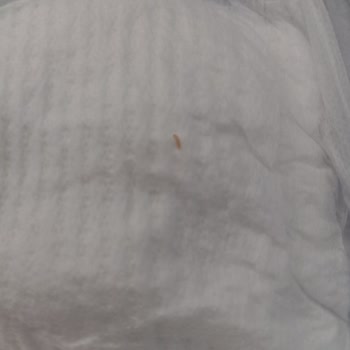 Molfix Bebek Bezi Paketinden Çıkan Kurtlar