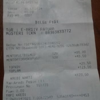 A101 Mağazasından Alınan Kusurlu Jilet Ve İade Sorunu