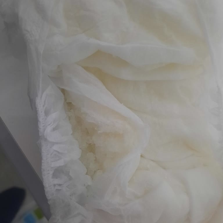 Yırtık Sleepy Külot Bezleri Çocuğumun Cildini Tahriş Etti